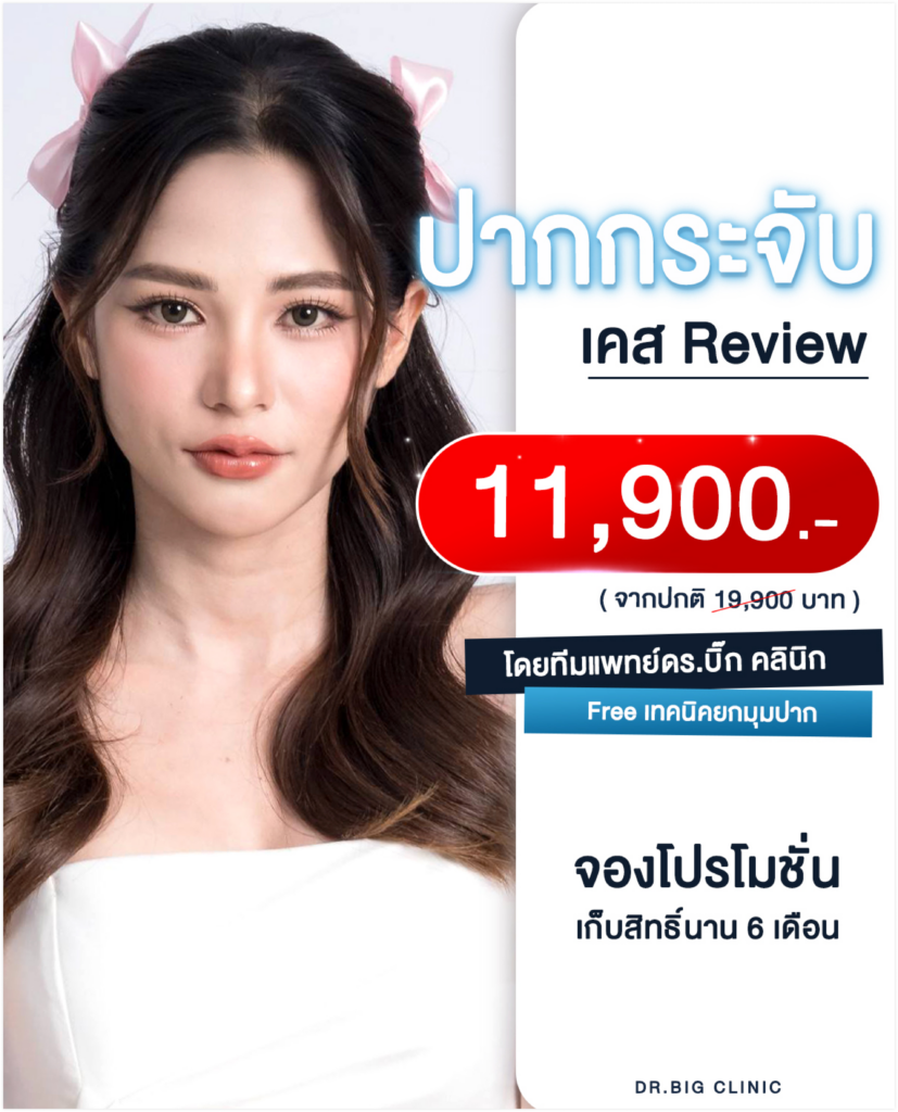 Full option ปากระจับ